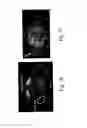 Fig. 09 - Use of non-labeled sugars and detection by MRI for assessing tissue perfusion and metabolism