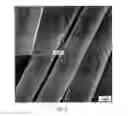Fig. 03 - Fibrin microthreads