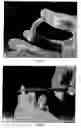 Fig. 02 - PLIABLE MEDICAL DEVICE AND METHOD OF USE