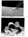 Fig. 03 - PLIABLE MEDICAL DEVICE AND METHOD OF USE
