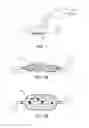 Fig. 02 - Negative pressure device
