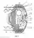 Fig. 11 - Apparatus for dispensing medicinal fluids and method of making same