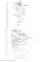 Fig. 07 - Fluid conduit assembly with gas trapping filter in the fluid flow path