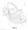 Fig. 04 - NASAL INTERFACE