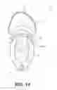 Fig. 19 - NASAL INTERFACE