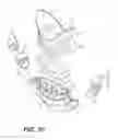 Fig. 26 - NASAL INTERFACE
