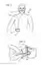Fig. 03 - Methods, systems and devices for non-invasive open ventilation for treating airway obstructions