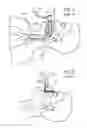 Fig. 04 - Methods, systems and devices for non-invasive open ventilation for treating airway obstructions