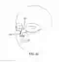 Fig. 14 - Methods, systems and devices for non-invasive open ventilation for treating airway obstructions