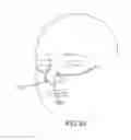 Fig. 16 - Methods, systems and devices for non-invasive open ventilation for treating airway obstructions