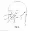 Fig. 19 - Methods, systems and devices for non-invasive open ventilation for treating airway obstructions