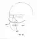Fig. 20 - Methods, systems and devices for non-invasive open ventilation for treating airway obstructions