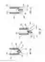 Fig. 31 - Methods, systems and devices for non-invasive open ventilation for treating airway obstructions