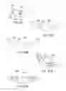 Fig. 34 - Methods, systems and devices for non-invasive open ventilation for treating airway obstructions