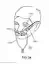 Fig. 37 - Methods, systems and devices for non-invasive open ventilation for treating airway obstructions
