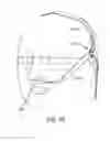 Fig. 40 - Methods, systems and devices for non-invasive open ventilation for treating airway obstructions