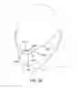 Fig. 41 - Methods, systems and devices for non-invasive open ventilation for treating airway obstructions