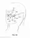 Fig. 48 - Methods, systems and devices for non-invasive open ventilation for treating airway obstructions