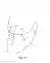 Fig. 49 - Methods, systems and devices for non-invasive open ventilation for treating airway obstructions