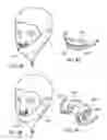 Fig. 65 - Methods, systems and devices for non-invasive open ventilation for treating airway obstructions