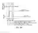Fig. 87 - Methods, systems and devices for non-invasive open ventilation for treating airway obstructions