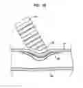 Fig. 08 - Implantable flow connector