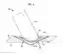 Fig. 10 - Implantable flow connector