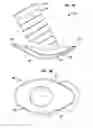 Fig. 14 - Implantable flow connector