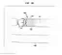 Fig. 20 - Implantable flow connector