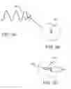 Fig. 04 - Methods and devices for urethral treatment