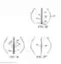 Fig. 05 - Methods and devices for urethral treatment