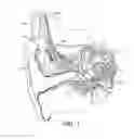 Fig. 02 - Modified electrode lead for cochlear implants
