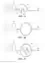 Fig. 09 - Modified electrode lead for cochlear implants