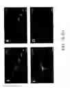 Fig. 03 - Methods and systems for reducing inflammation by neuromodulation and administration of an anti-inflammatory drug