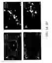 Fig. 04 - Methods and systems for reducing inflammation by neuromodulation and administration of an anti-inflammatory drug