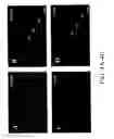 Fig. 05 - Methods and systems for reducing inflammation by neuromodulation and administration of an anti-inflammatory drug