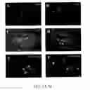 Fig. 06 - Methods and systems for reducing inflammation by neuromodulation and administration of an anti-inflammatory drug