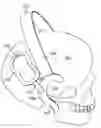 Fig. 01 - Template for bilateral symmetric stimulator fixation/implantation