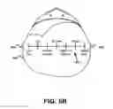 Fig. 07 - Fitting bilateral hearing prostheses