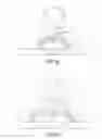 Fig. 07 - Electronic stimulation system and device thereof for dorsal root ganglion
