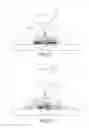 Fig. 08 - Electronic stimulation system and device thereof for dorsal root ganglion