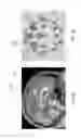 Fig. 04 - Enhanced spatial summation for deep-brain transcranial magnetic stimulation