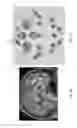 Fig. 05 - Enhanced spatial summation for deep-brain transcranial magnetic stimulation