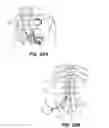 Fig. 23 - SYSTEM AND METHOD FOR OPTOGENETIC THERAPY