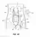 Fig. 42 - SYSTEM AND METHOD FOR OPTOGENETIC THERAPY