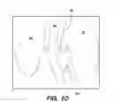 Fig. 44 - SYSTEM AND METHOD FOR OPTOGENETIC THERAPY