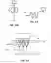 Fig. 87 - SYSTEM AND METHOD FOR OPTOGENETIC THERAPY