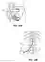 Fig. 23 - System and method for optogenetic therapy