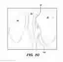Fig. 44 - System and method for optogenetic therapy