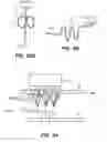 Fig. 87 - System and method for optogenetic therapy